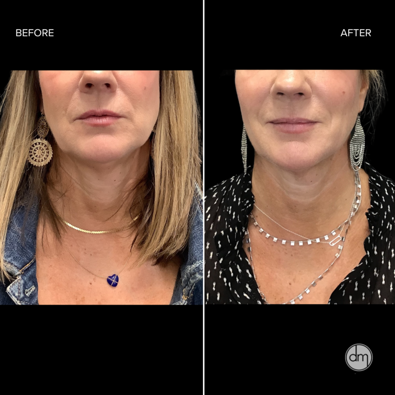 Laser Skin Care Solutions - Revised 2