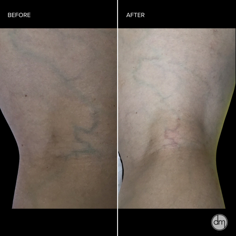 Laser Skin Care Solutions - Revised 3