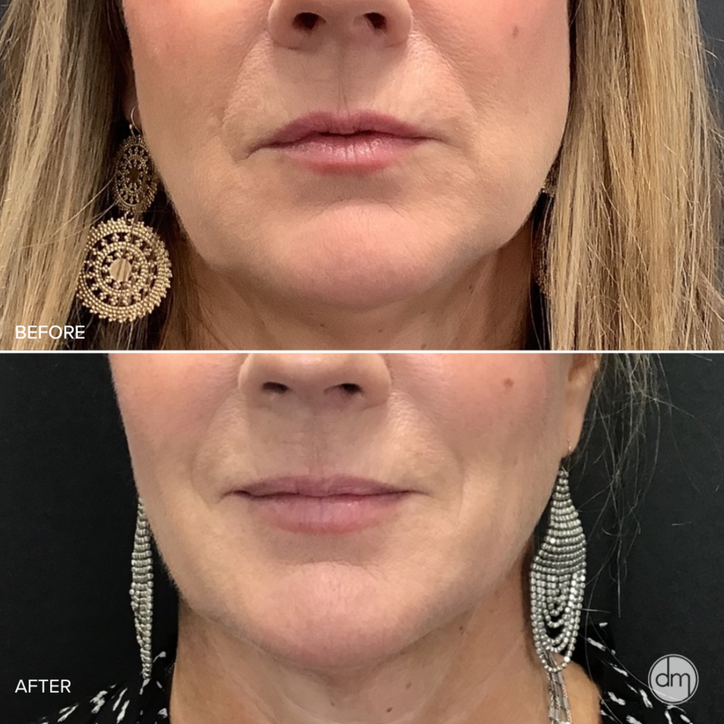 Laser Skin Care Solutions - revised